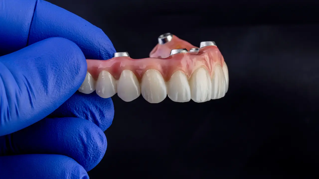 Implant Overdentures at Dogwood Family Dentistry in Albemarle, NC