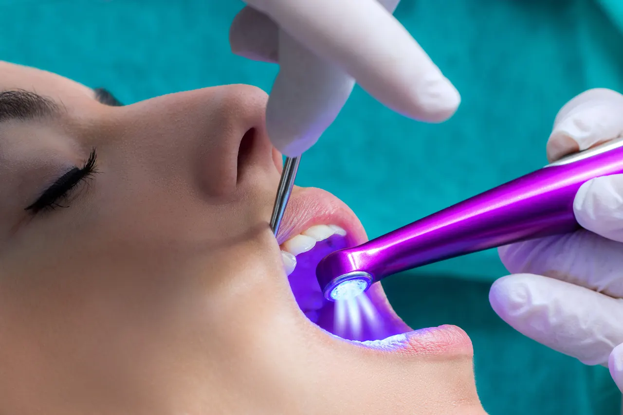 Dental Sealants in Albemarle, NC — Protection for Kids & Adults at Dogwood Family Dentistry in Albemarle, NC